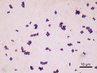 Vi khuẩn Staphylococcus dưới kính hiển vi