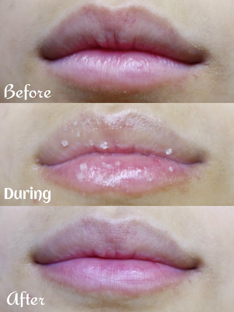 free load How To Remove Cracks On Lips redloadcrack