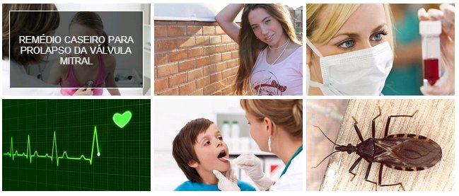 Artigos relacionados com imagens artigos relacionados imagens blogger grátis