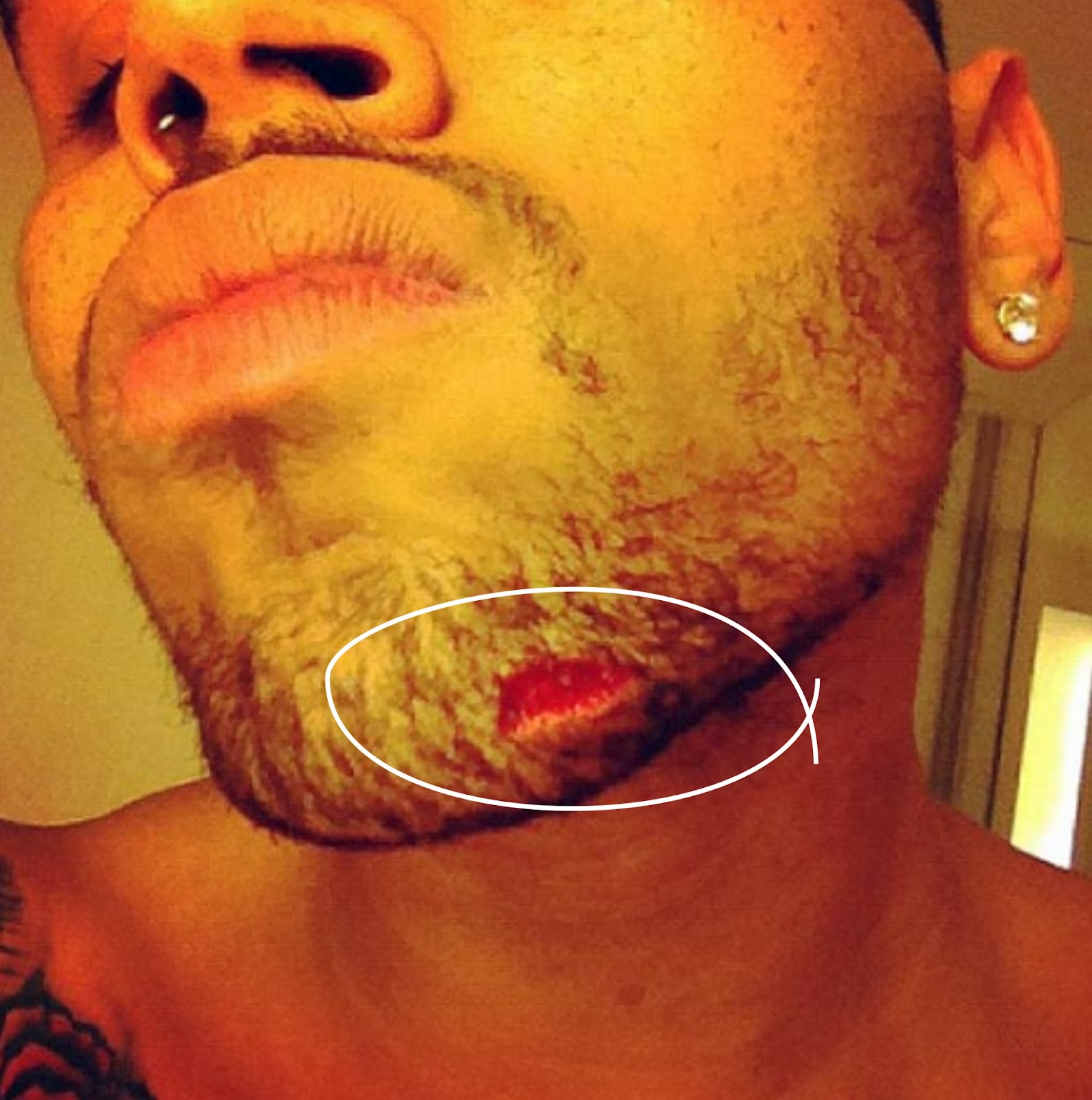 Chris Brown has been left with a bloody gash on his chin after a reported f...