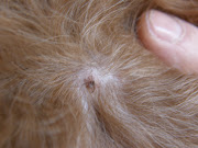 Finally, I hauled Mox off to the vet with a baggie full of the wriggling . (tick in fur)