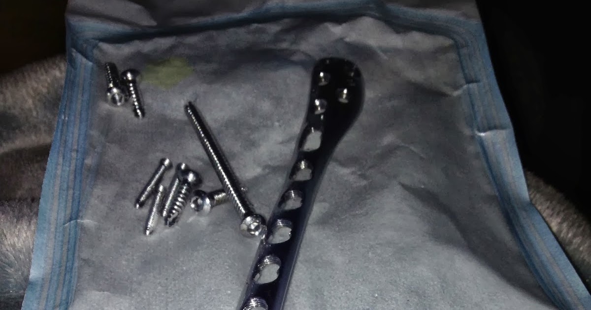 My Broken Ankle Journey Hardware removal...be gone you nasty infection