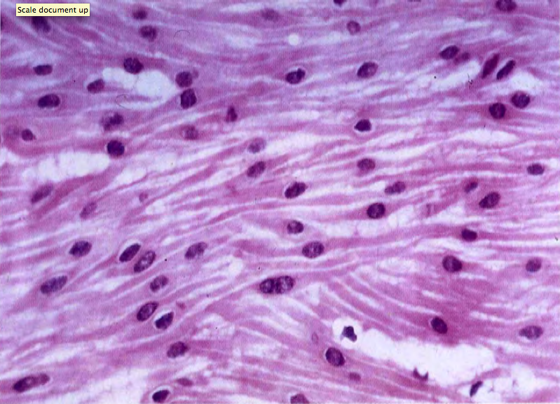 Histology Doodles: Smooth Muscle. H&E