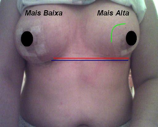 Nata de extensões de peito durante a alimentação