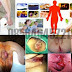 Ciri2 Orang Ambeien..!! thumbnail