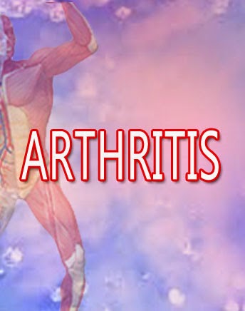 TERAPI HERBAL ANEMIA terapi-obat-rematik-reumatik-arthritis-herbal-nasa