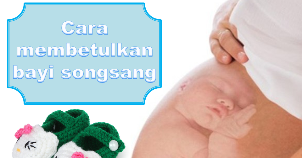 Cara membetulkan bayi songsang supaya boleh bersalin