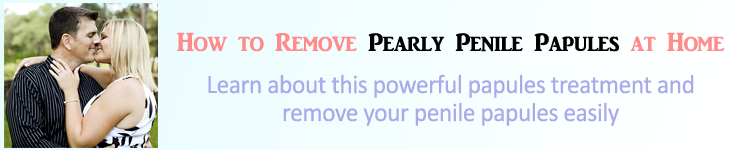 How to Remove Pearly Penile Papules at Home