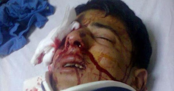 BASINDAN SEÇMELER 2013 Kapsül gözünü kör etti