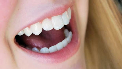 Cara Baik dan Benar Menjaga Kesehatan Mulut dan Gigi
