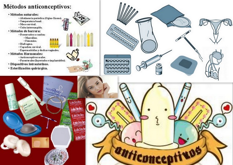 Los anticonceptivos clásicos y los recientes Alberto Kaplan