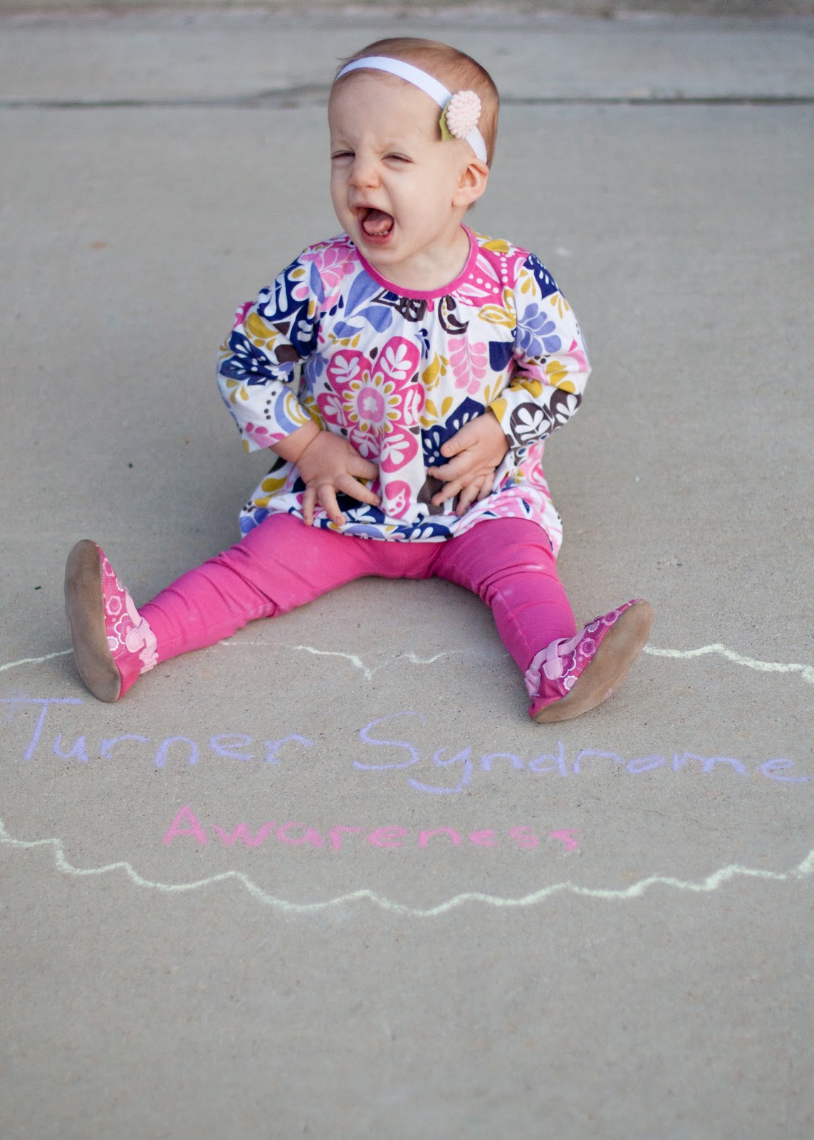 Aubrey Jane: February is Turner Syndrome Awareness Month-25 Facts On TS