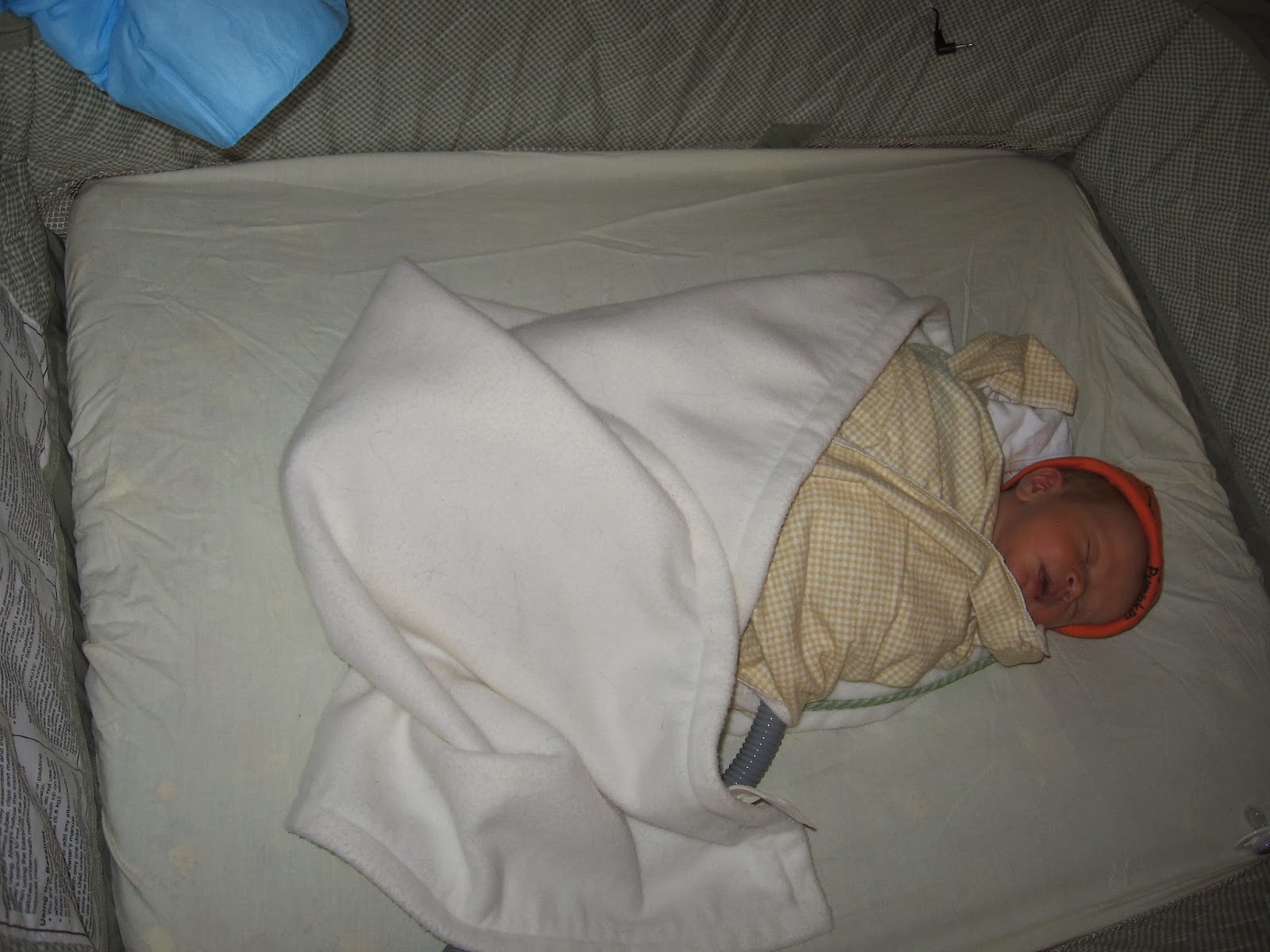 Jessica on Babies Jaundice, Part II What is Jaundice and How is it