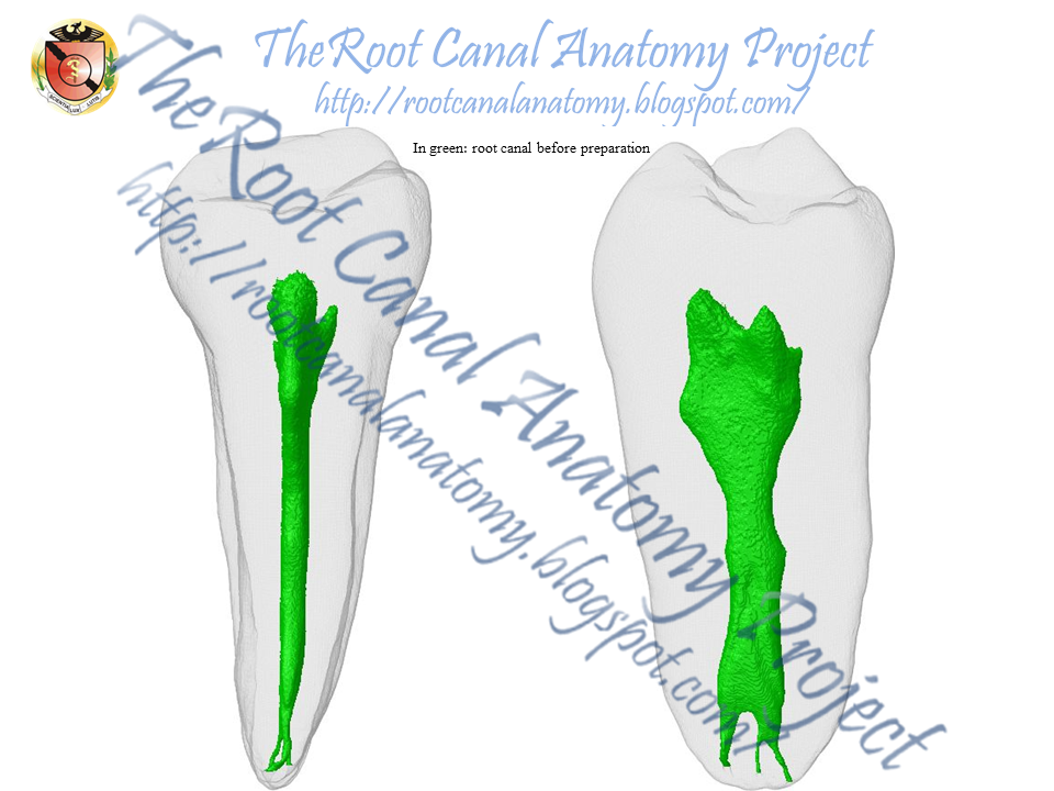 A mandíbula de Caim” – projeto do professor Peterson – Campus Irati