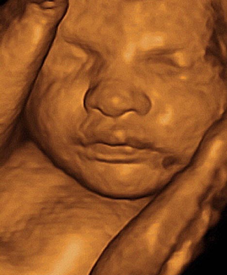 3d Puzzle Image 3d Ultrasounds