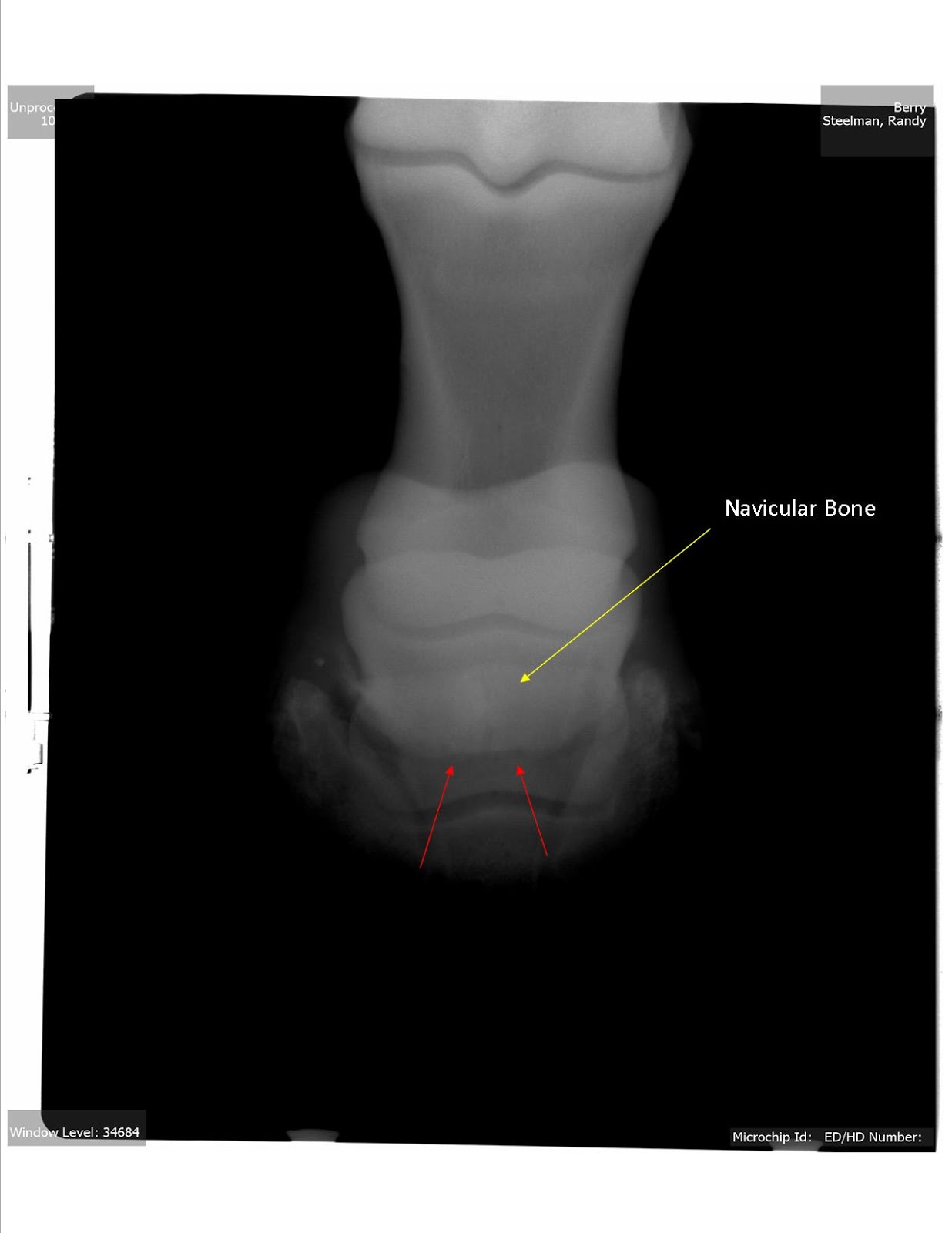 CurOST Equine Navicular Disease (Podotrochleosis)
