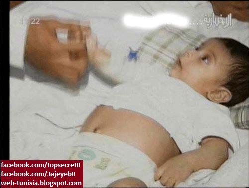  طفل سعودي يبلغ من العمر سنة حامل  Tefl+3