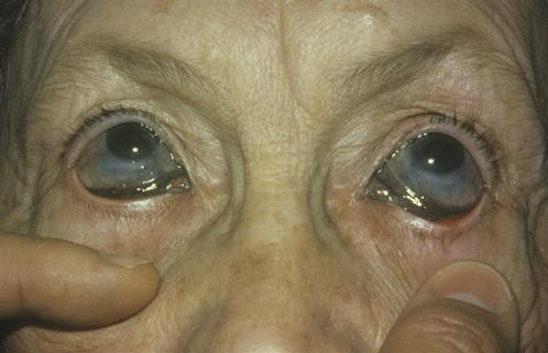 Colloidal silver research papers