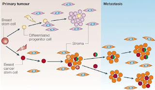 Metastasis