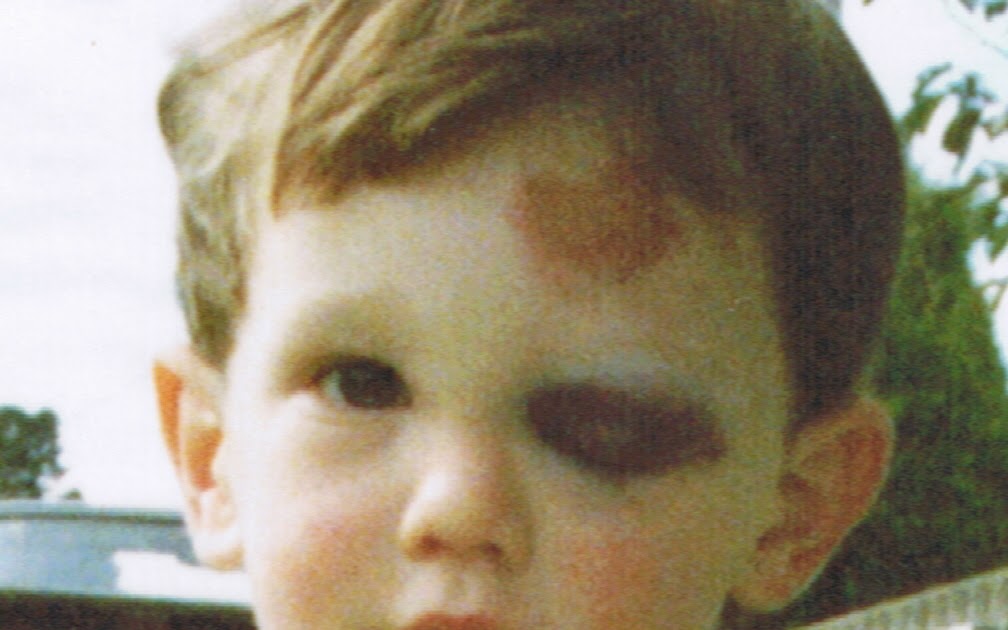 Stop These Jokes "The Other Guy"