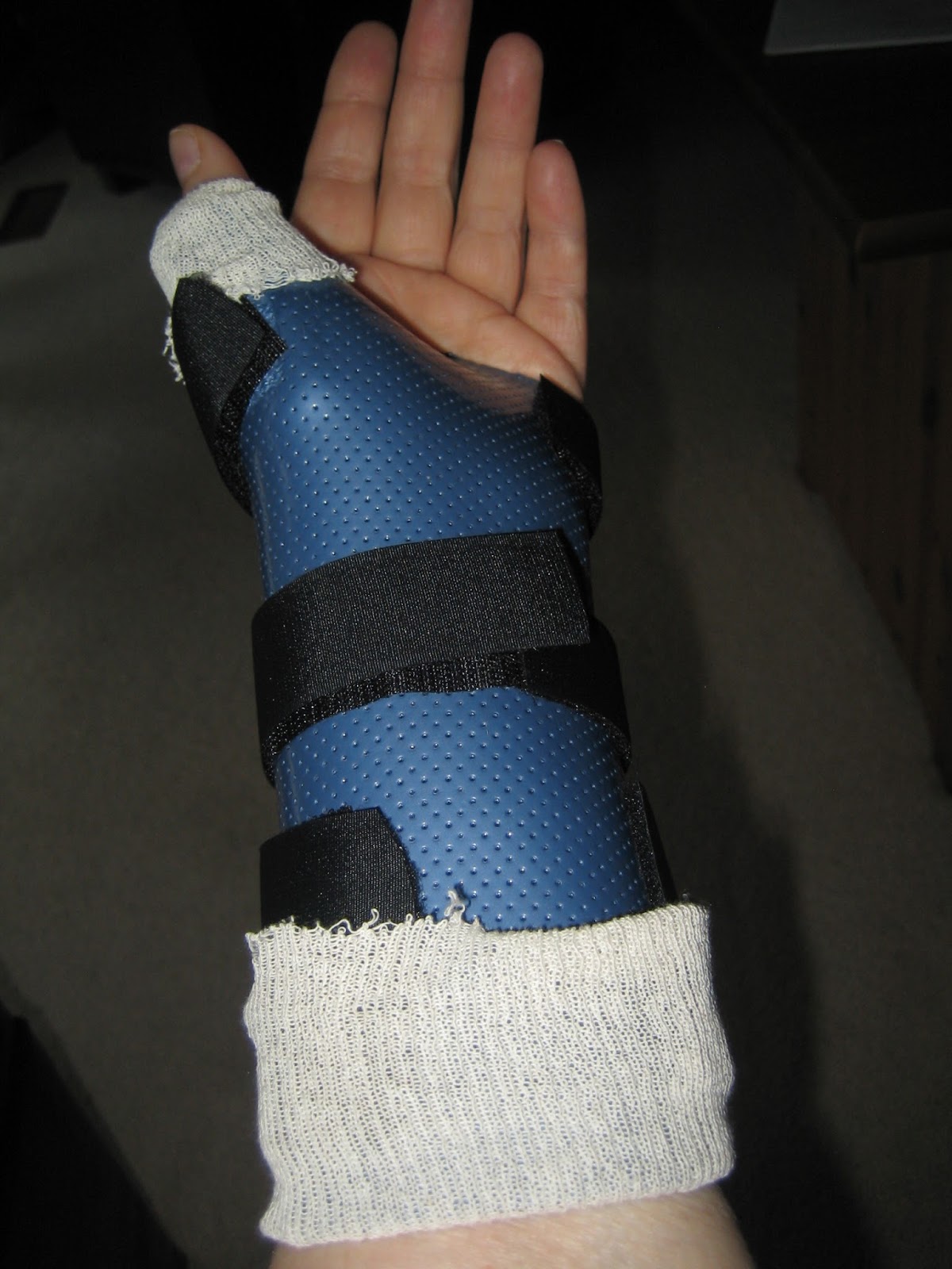 Quilting Momma & The Youngest 11 days post surgery Basal thumb