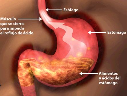 ENFERMEDADES QUE CAUSAN DOLOR enfermedades que causan dolor: