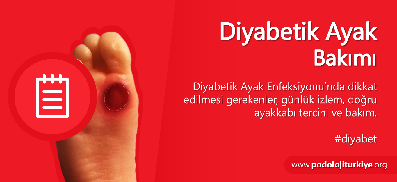 Diyabetik Ayak Bakımı