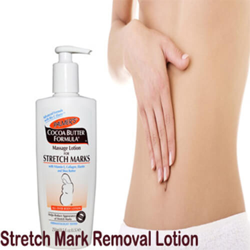 Stretch Marks Removal Cream