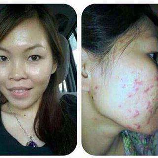 Testimoni La’Soul Diamond Hydration Sleeping Mask Testimoni La’Soul Diamond Hydration Sleeping Mask, la'soul sleeping mask testimoni, la'soul sleeping mask review, testimoni lasoul sleeping mask, testimoni la soul sleeping mask,testimoni la soul diamond, diamond white hydration sleeping mask