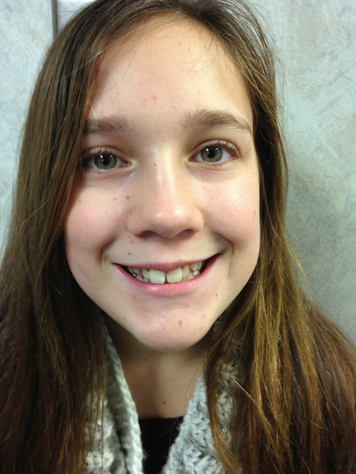 My Little Corner of Heaven Pawlak Style Grace BEFORE Braces