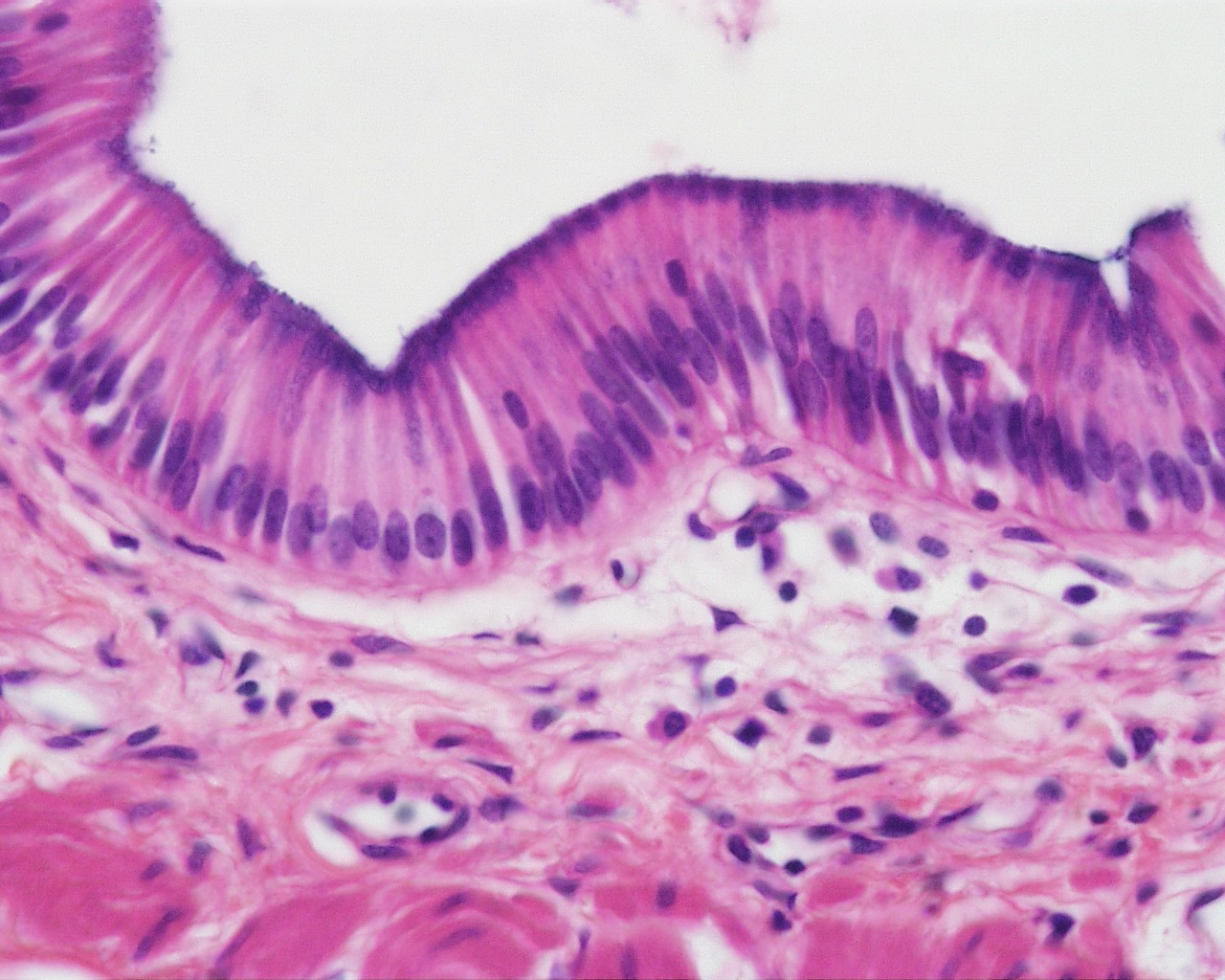 Anatomy and Physiology I Coursework: Epithelial Tissues
