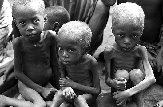 African Children Starving