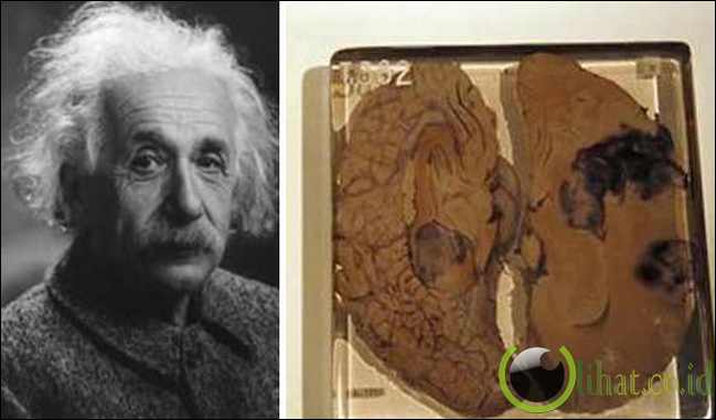 Otak Einstein Otak Einstein