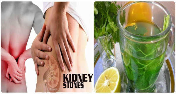 Powerful syrup for removing kidney stones (Recipe) remedies for kidney stones