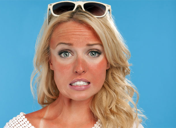 sunburn.jpg