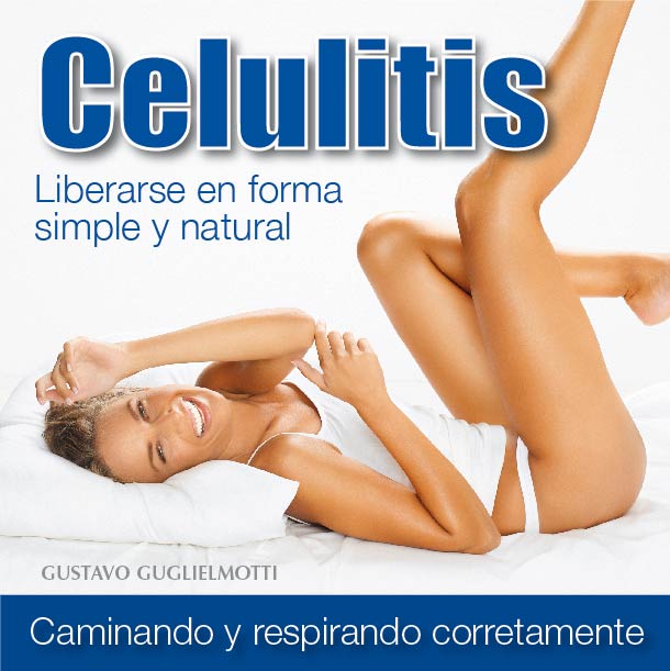 Celulitis