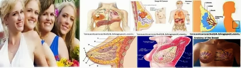 What Is Breast Cancer- What Causes Breast Cancer-Breast cancer symptom 