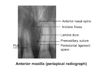 Slide14.JPG