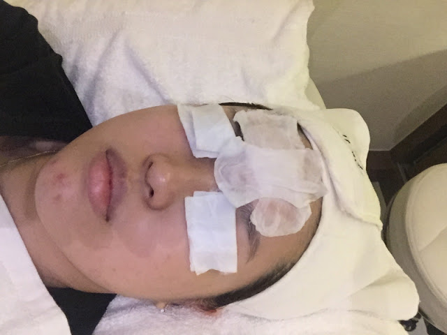 Simply Aesthetics Oxycious Facial Treatment Review Lunarrive Singapore Lifestyle Blog Simply Aesthetics Oxycious Facial Treatment Review Lunarrive Singapore Lifestyle Blog