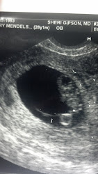 8w6d ultrasound