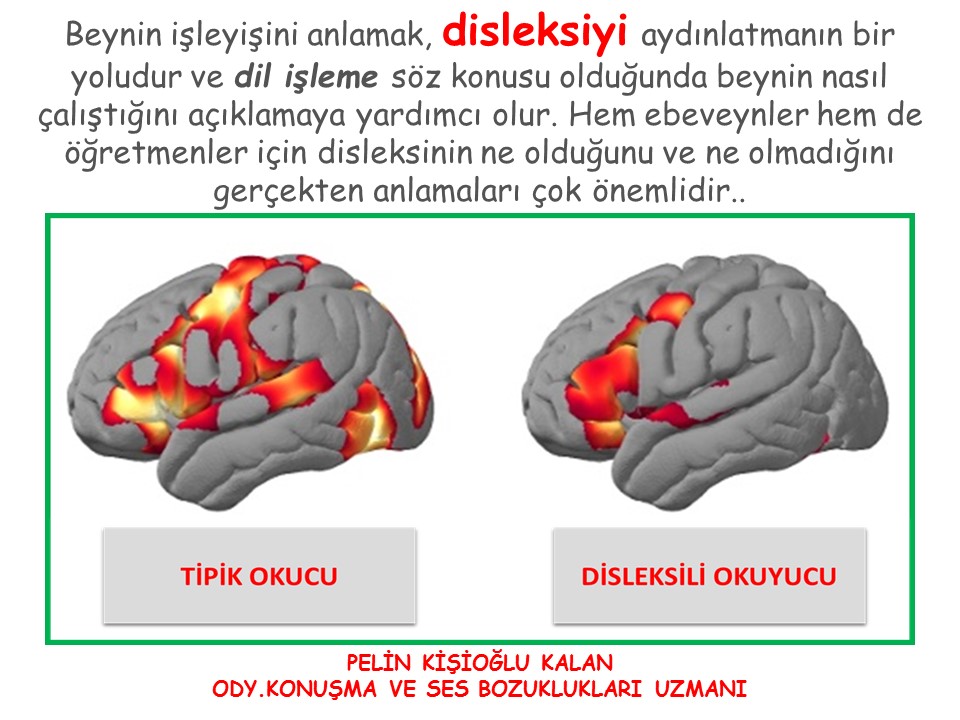 DİSLEKSİ VE OKUMA