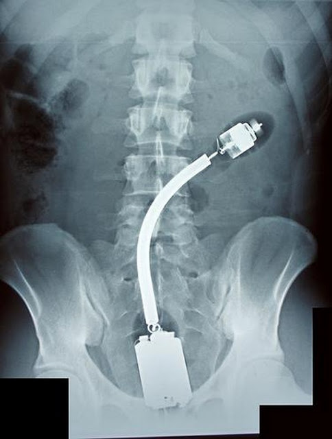 Азиатские Секс Игрушки