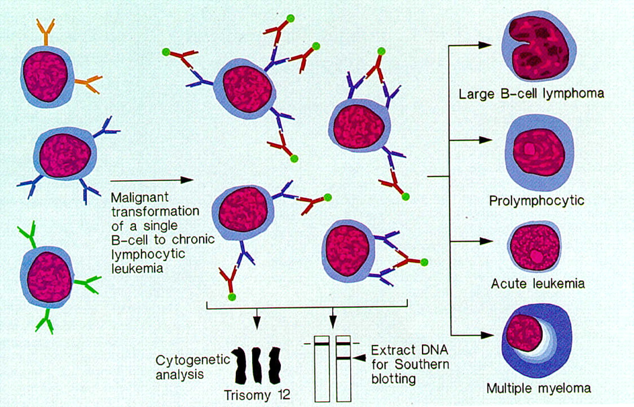 New methods of treatment of leukemia in children Tips