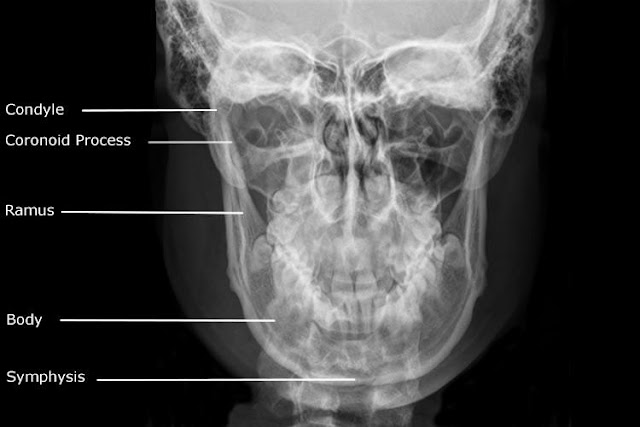 Dentistry lectures for MFDS/MJDF/NBDE/ORE: Radiographic Anatomy of