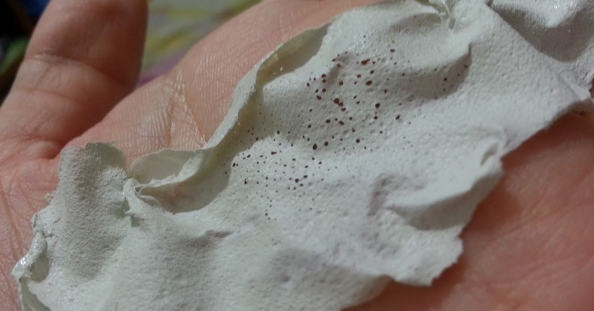 Blackhead Hole On Back Organic Blackheads Remedies Cye Thamma