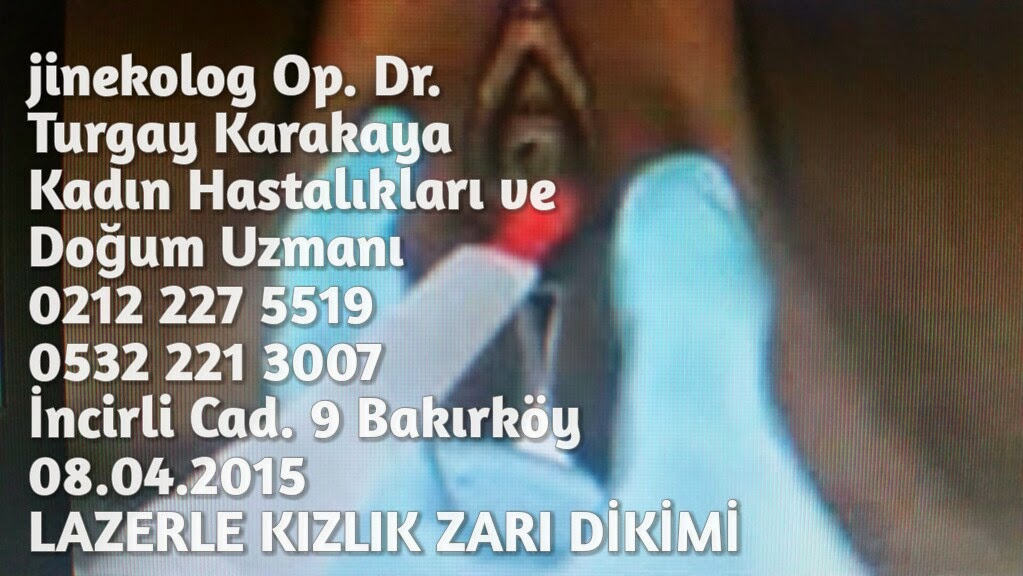 Lazerle Kizlik Zari Dikimi Lazerle Kizlik Zari Dikimi