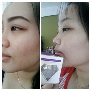 Testimoni La’Soul Diamond Hydration Sleeping Mask, la'soul sleeping mask testimoni, la'soul sleeping mask review, testimoni lasoul sleeping mask, testimoni la soul sleeping mask,testimoni la soul diamond, diamond white hydration sleeping mask