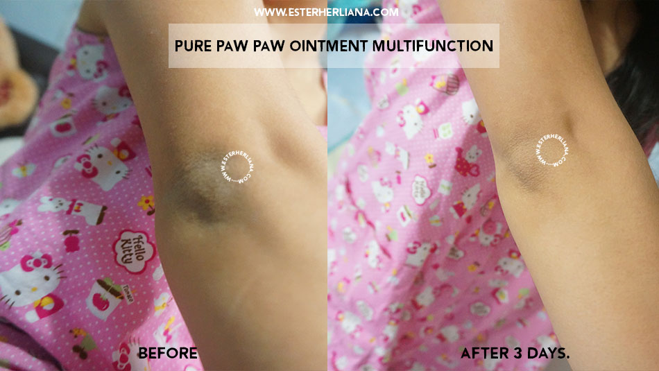Review Pure Paw Paw Ointment Multifunction Esterherliana