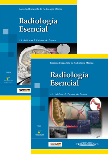 seram radiologia esencial pdf