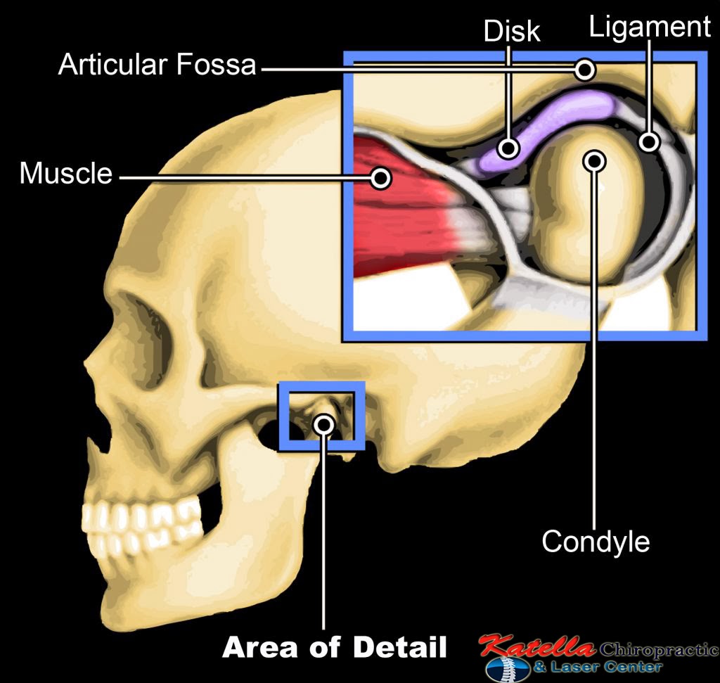 TMJ Disorder